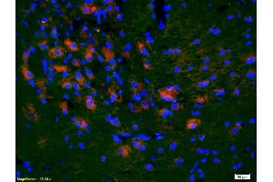Formalin-fixed and paraffin-embedded rat brain labeled with Anti-KLF5/UKHC Polyclonal Antibody, Unconjugated (ABIN739515) 1:200, overnight at 4°C, The secondary antibody was Goat Anti-Rabbit IgG, Cy3 conjugated used at 1:200 dilution for 40 minutes at 37°C. (KLF5 抗体  (AA 61-160))