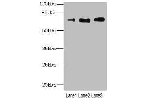 Western blot All lanes: CD180 antibody at 3.
