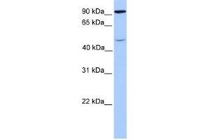 WB Suggested Anti-STAT5B Antibody Titration: 1 ug/ml Positive Control: Fetal Brain Lysate (STAT5B 抗体  (C-Term))