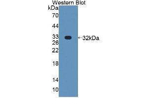 Western blot analysis of the recombinant protein. (PLCH1 抗体  (AA 1-237))