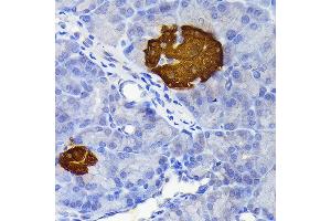 Immunohistochemistry (IHC) image for anti-Secretagogin, EF-Hand Calcium Binding Protein (SCGN) antibody (ABIN7270178)