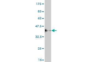 Western Blot detection against Immunogen (36. (ASCL1 抗体  (AA 137-236))