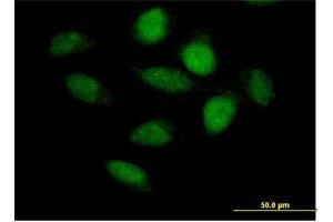 Immunofluorescence of purified MaxPab antibody to APBB3 on HeLa cell. (APBB3 抗体  (AA 1-486))