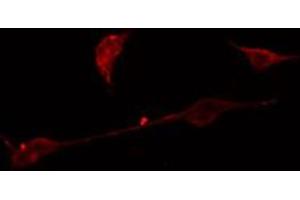 ABIN6275050 staining A549 cells by IF/ICC. (AGBL4 抗体  (C-Term))