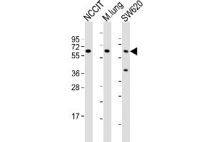All lanes : Anti-TGFBR2 Antibody (N-term) at 1:2000 dilution Lane 1: NCCIT whole cell lysates Lane 2: mouse lung lysates Lane 3: S whole cell lysates Lysates/proteins at 20 μg per lane. (TGFBR2 抗体  (N-Term))