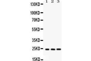 Western Blotting (WB) image for anti-BCL2-Associated Athanogene 2 (BAG2) (AA 1-211) antibody (ABIN3043508) (BAG2 抗体  (AA 1-211))