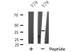 Western blot analysis of extracts of Y79 cell lines, using SPARC antibody. (SPARC 抗体  (Internal Region))
