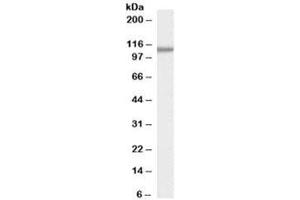 Western blot testing of human pancreas lysate with SMEK1 antibody at 0. (SMEK1 抗体)