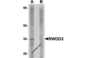 Western Blotting (WB) image for anti-RWD Domain Containing 3 (RWDD3) (C-Term) antibody (ABIN1030633) (RWDD3 抗体  (C-Term))