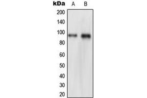 Western blot analysis of NVL expression in HeLa (A), THP1 (B) whole cell lysates. (NVL 抗体  (Center))