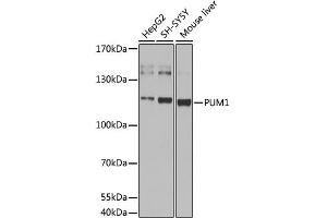 Western blot analysis of extracts of various cell lines, using pum1 antibody (ABIN6293483) at 1:1000 dilution. (PUM1 抗体)