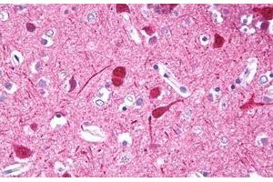 Anti-HMX3 antibody IHC of human brain, cortex neurons. (HMX3 抗体  (AA 193-224))