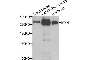 Western blot analysis of extracts of various cell lines, using MYH1 antibody. (MYH1 抗体)