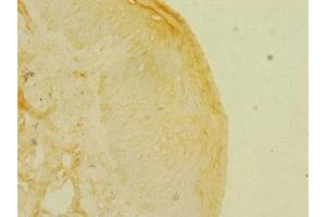 Immunohistochemistry of paraffin-embedded human skin tissue using ABIN7157698 at dilution of 1:100 (KREMEN1 抗体  (AA 180-380))