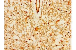 Immunohistochemistry of paraffin-embedded human brain tissue using ABIN7159356 at dilution of 1:100 (MAGI2 抗体  (AA 1308-1455))