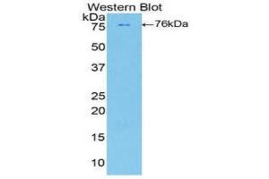 Western Blotting (WB) image for anti-Phospholipase A2-Activating Protein (PLAA) (AA 534-792) antibody (ABIN1860255) (PLAA 抗体  (AA 534-792))