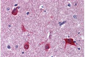 Human Brain, cortex: Formalin-Fixed, Paraffin-Embedded (FFPE) (EEF1A2 抗体  (AA 238-443))