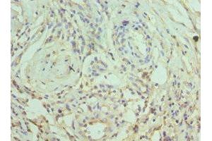 Immunohistochemistry of paraffin-embedded human epityphlon tissue using ABIN7169786 at dilution of 1:100 (SLAMF7 抗体  (AA 23-226))