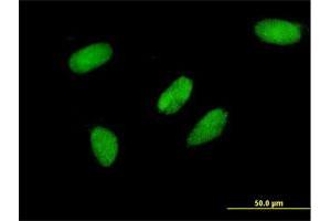 Immunofluorescence of monoclonal antibody to TCEA3 on HeLa cell. (TCEA3 抗体  (AA 1-348))