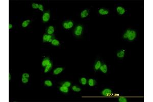 Immunofluorescence of monoclonal antibody to MED31 on HeLa cell. (MED31 抗体  (AA 1-131))