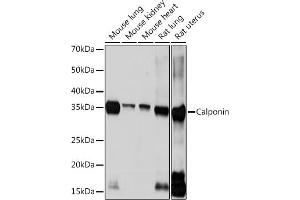 Western blot analysis of extracts of various cell lines, using Calponin Rabbit mAb (ABIN1678670, ABIN3018018, ABIN3018019 and ABIN7101568) at 1:1000 dilution. (CNN1 抗体)