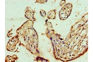 Immunohistochemistry of paraffin-embedded human placenta tissue using ABIN7143011 at dilution of 1:100 (PHAP1 抗体  (AA 1-170))