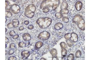 Immunoperoxidase of monoclonal antibody to OXSR1 on formalin-fixed paraffin-embedded human small Intestine. (OXSR1 抗体  (AA 1-527))