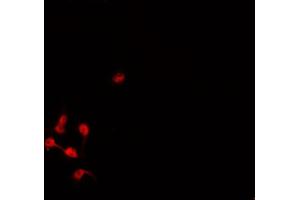 ABIN6276956 staining HepG2? (DLC1 抗体  (N-Term))