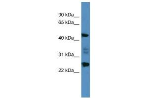 WB Suggested Anti-OSGIN2 Antibody Titration: 0.