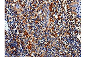 The image is immunohistochemistry of paraffin-embedded Human tonsil tissue using ABIN7129010(COX16 Antibody) at dilution 1/50. (COX16 抗体)