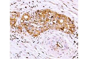 IHC analysis of AGPAT2 using anti-AGPAT2 antibody (ABIN7602435). (AGPAT2 抗体  (AA 77-178))