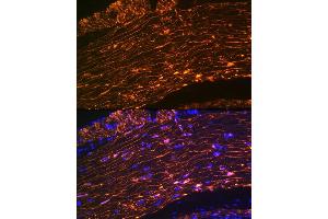 Immunofluorescence analysis of rat rectum using Calponin Rabbit mAb (ABIN1678670, ABIN3018018, ABIN3018019 and ABIN7101568) at dilution of 1:100 (40x lens). (CNN1 抗体)