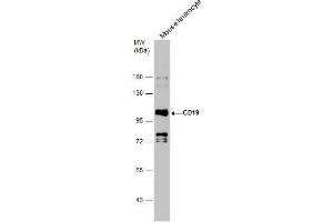 Western Blotting (WB) image for anti-CD19 Molecule (CD19) antibody (ABIN2855077)