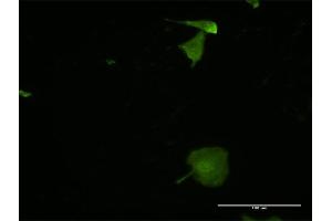 Immunofluorescence of monoclonal antibody to MPZL2 on HeLa cell.