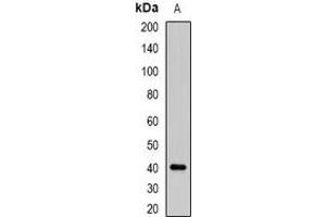 Western blot analysis of ABO expression in K562 (A) whole cell lysates. (ABO 抗体)