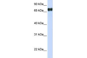 WB Suggested Anti-PLEKHA4 Antibody Titration:  0. (PLEKHA4 抗体  (N-Term))