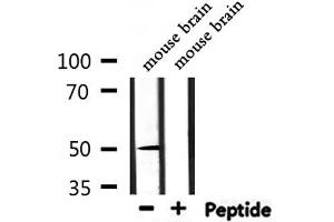 Western Blotting (WB) image for anti-Nuclear Receptor Subfamily 1, Group H, Member 3 (NR1H3) (C-Term) antibody (ABIN6263715)