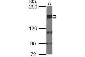 Western Blotting (WB) image for anti-Zinc Finger, MYM-Type 2 (ZMYM2) (Center) antibody (ABIN2856121)