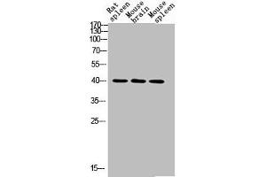 Western blot analysis of RAT-SPLEEN MOUSE-BRAIN MOUSE-SPLEEN lysis using CD72 antibody. (CD72 抗体  (Internal Region))