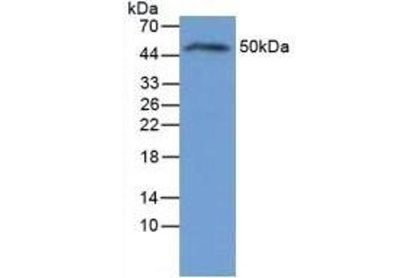 IL-6 Receptor 抗体