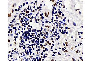 Immunohistochemistry analysis of paraffin-embedded human gallbladder using c-Fos Monoclonal Antibody at dilution of 1:1000.