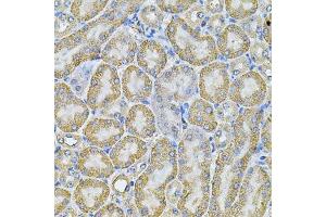 Immunohistochemistry (Paraffin-embedded Sections) (IHC (p)) image for anti-Adaptor-Related Protein Complex 2, alpha 1 Subunit (AP2A1) (AA 1-260) antibody (ABIN6136952)