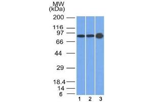 Western blot testing of human 1) U87, 2) HeLa and 3) A431 cell lysate with Plakophilin 1 antibody (clone 10B2). (Plakophilin 1 抗体  (N-Term))