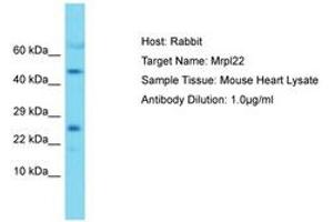Image no. 1 for anti-Mitochondrial Ribosomal Protein L22 (MRPL22) (AA 91-140) antibody (ABIN6750491) (MRPL22 抗体  (AA 91-140))