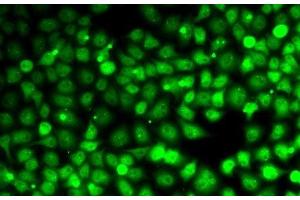 Immunofluorescence analysis of MCF7 cells using CCNE2 Polyclonal Antibody (Cyclin E2 抗体)