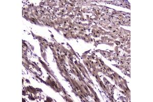 IHC testing of FFPE rat heart tissue with NFIB antibody at 1ug/ml. (NFIB 抗体)