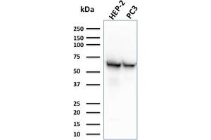 Western Blot Analysis of HEP-2 and PC3 cell lysates using HSP60 Mouse Monoclonal Antibody (CPTC-HSPD1-1). (HSPD1 抗体)