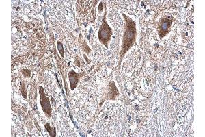 Immunohistochemistry (IHC) image for anti-Tubulin, beta (TUBB) antibody (ABIN2854998)