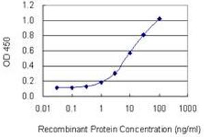 Detection limit for recombinant GST tagged CD5 is 0. (CD5 抗体  (AA 403-495))