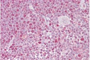 Immunohistochemistry (IHC) image for anti-Nuclear Factor of Activated T-Cells, Cytoplasmic, Calcineurin-Dependent 2 (NFAT1) (C-Term) antibody (ABIN2780879)